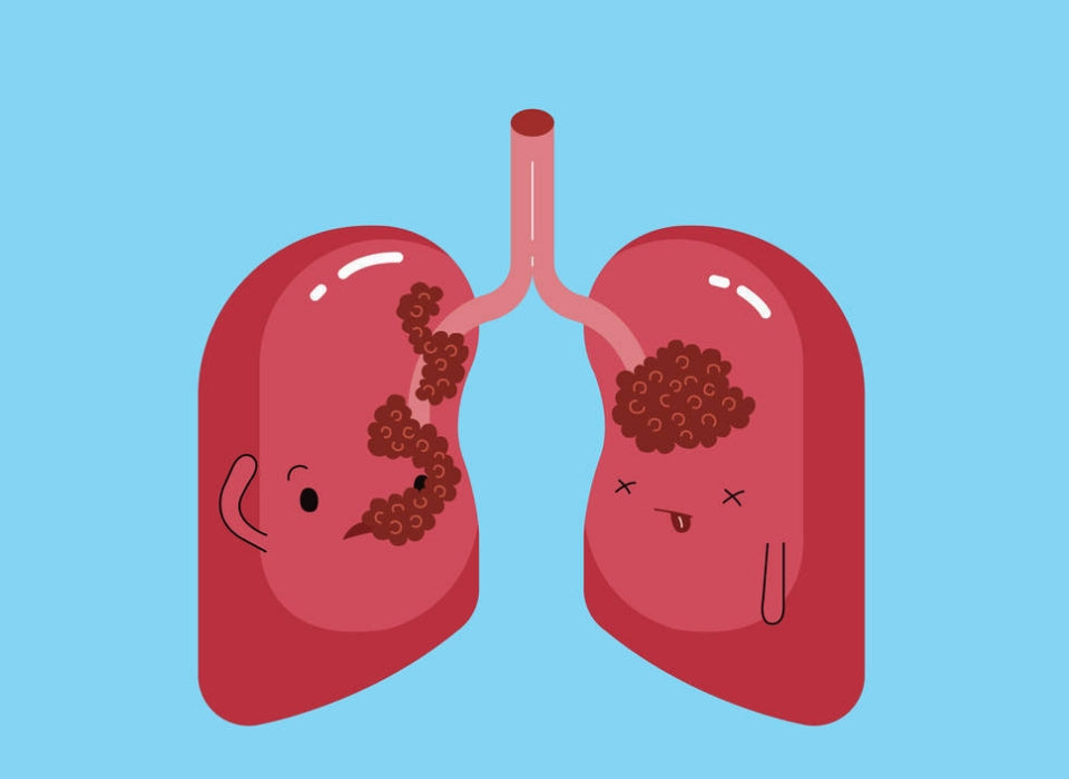 PGL PREVENT PULMONARY FIBROSIS CAUSED BY ANTICANCER DRUGS