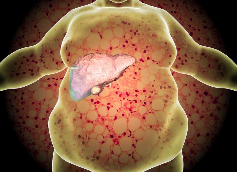 GANODERMA LUCIDUM AMELIORATES NON-ALCOHOLIC STEATOSIS