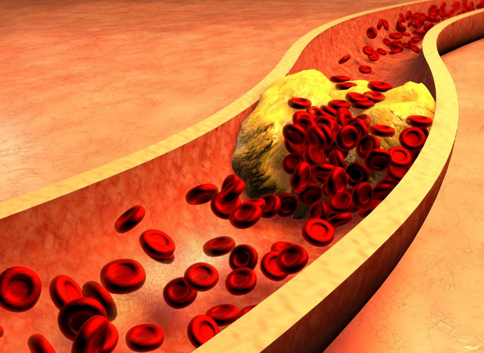 G. LUCIDUM PSP CAN REDUCE THE RISK OF ATHEROSCLEROSIS